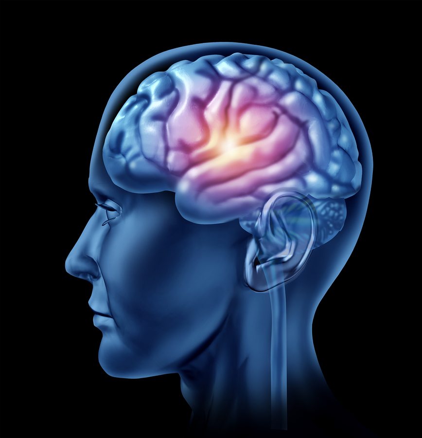Home Health Care in Aventura FL: Traumatic Brain Injury