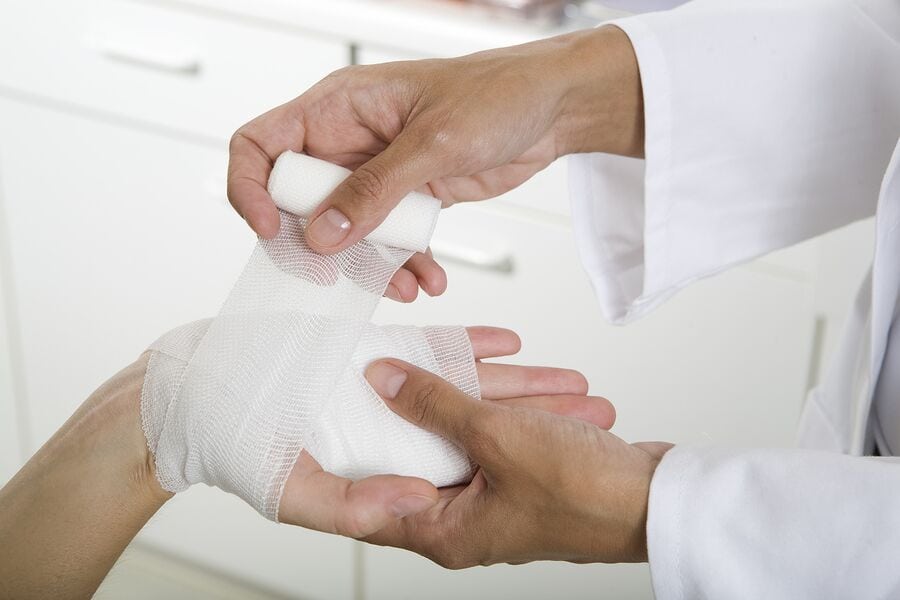 Home Health Care in Tamarac FL: Treating a Burn at Home